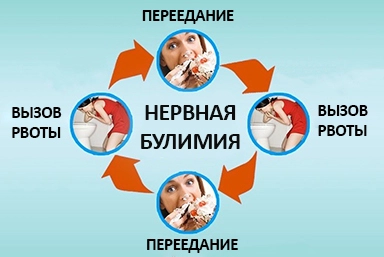 Лечение булимии в Красноуральске
