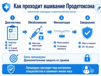 Имплантация Продетоксон в Красноуральске
